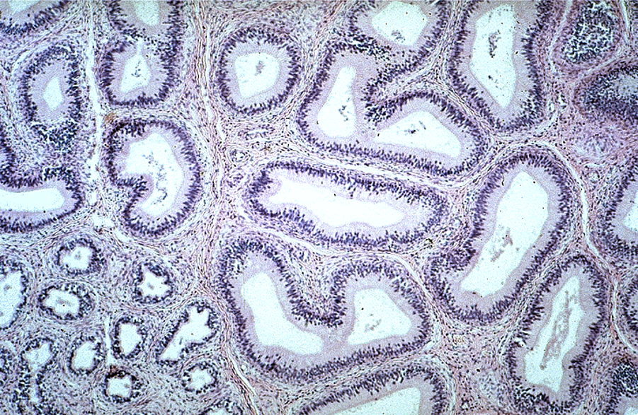 <p>Epididymis, in both tangential and longitudinal sections.  Note also some ducti efferentes in the lower right corner.</p>