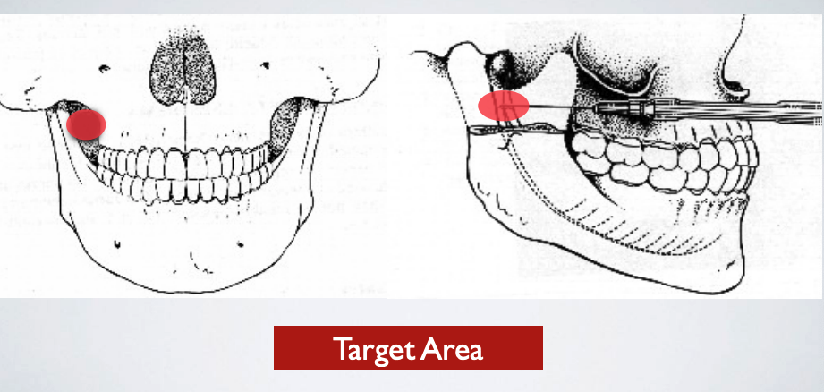 <p>target areas for which technqieu?</p>