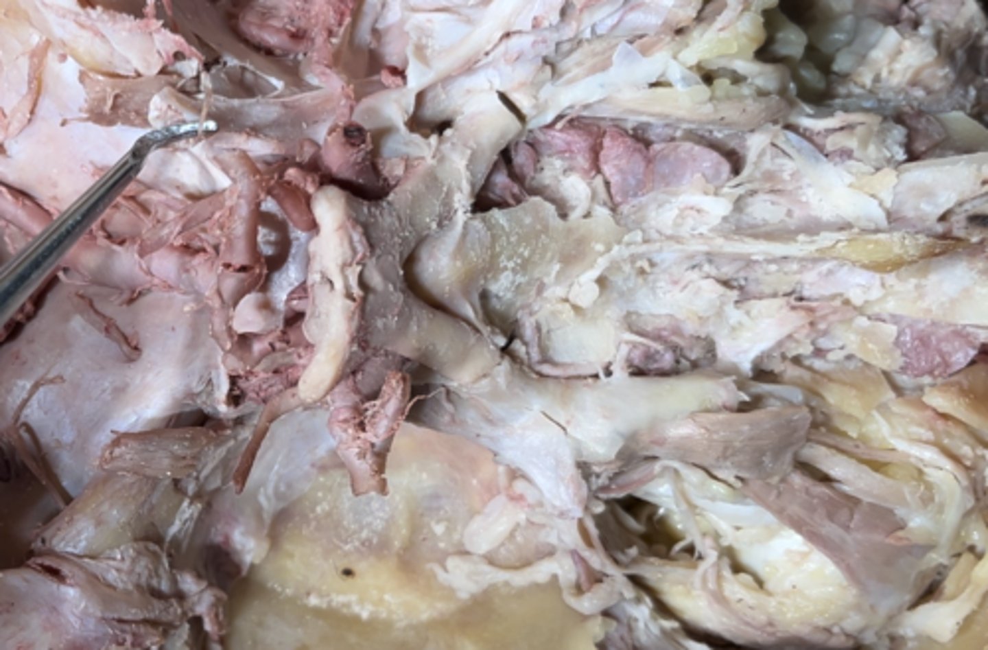 <p>The nerve that is super duper tiny eetsy weensy point at is the</p>