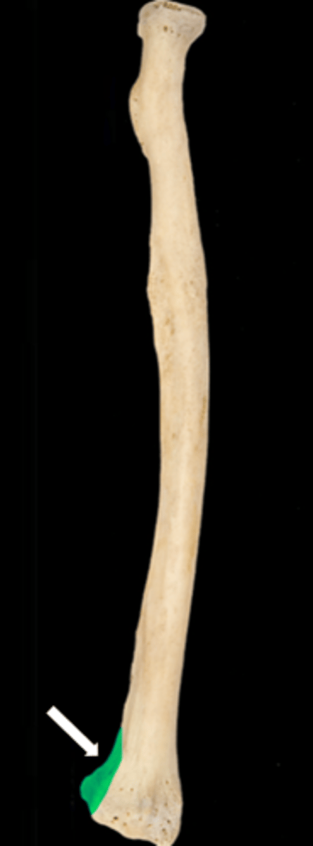 <p>name the part</p>