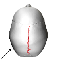 <p>Between 2 parietal bones</p>