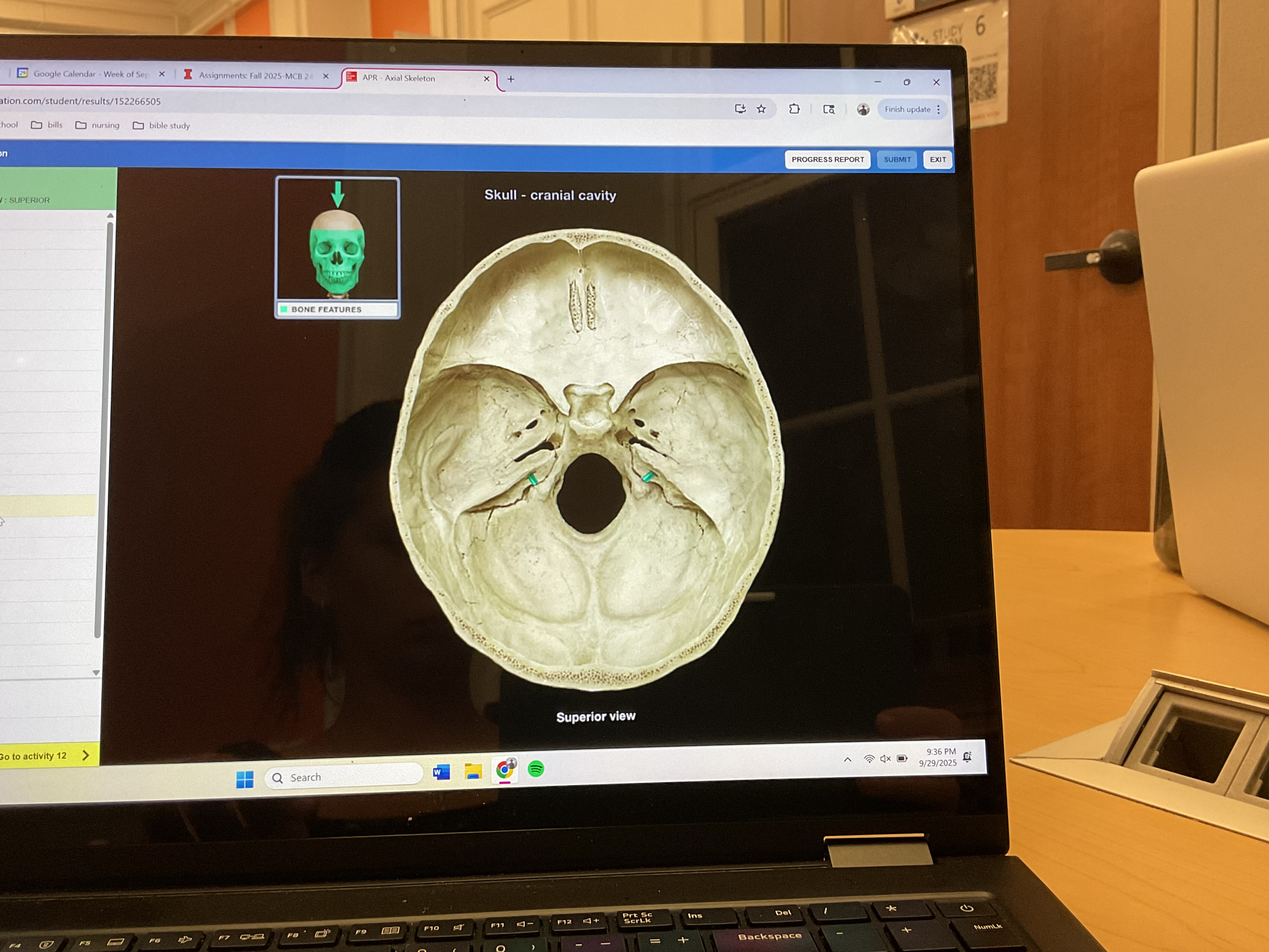 <p>Internal acoustic meatus</p>