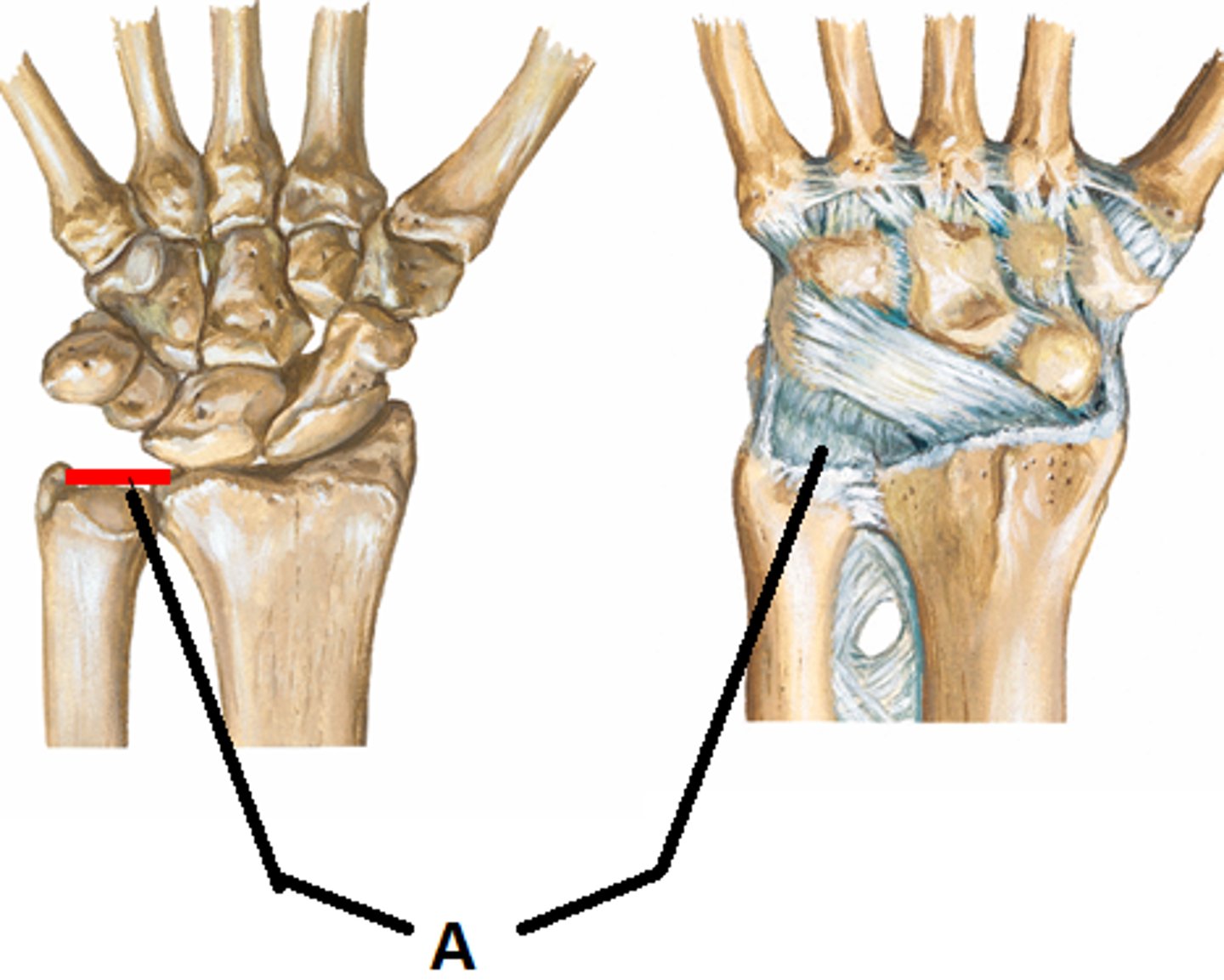 <p>The TFC portion of the</p><p>TFCC</p><p>Avascular</p><p>Looks like a 'trampoline'</p>
