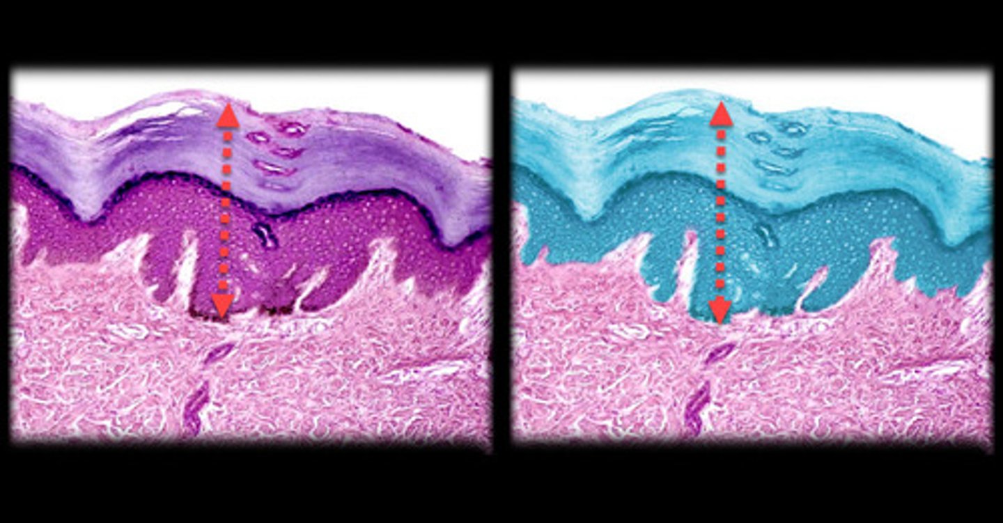 <p>- Outermost layer of skin composed of tightly packed epithelial cells.</p><p>- Appears as a thin, multi-layered structure with the outermost cells being flat and dead, gradually becoming more cuboidal or columnar toward the deeper layers.</p><p>- Often looks like a clear boundary separating the outer environment from the underlying dermis.</p>