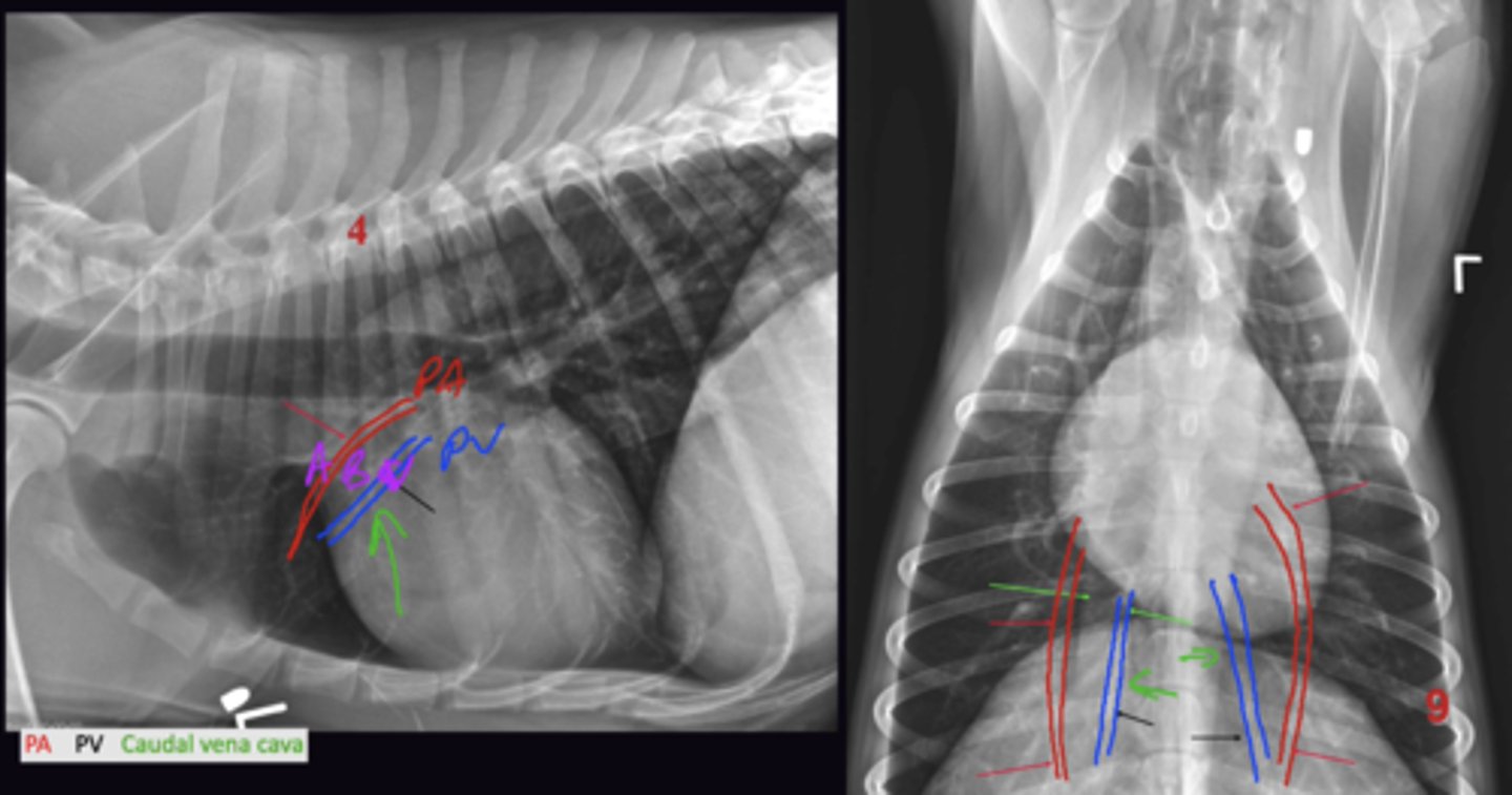 <p>1. "Dorsal + Lateral (Lateral + VD View)</p><p>2. "Ventral + Central" (Lateral + VD View)</p><p>3. Between Arteries and Veins</p>