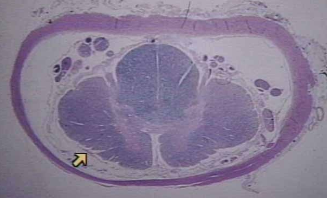 <p>What is the arrow pointing at?</p>