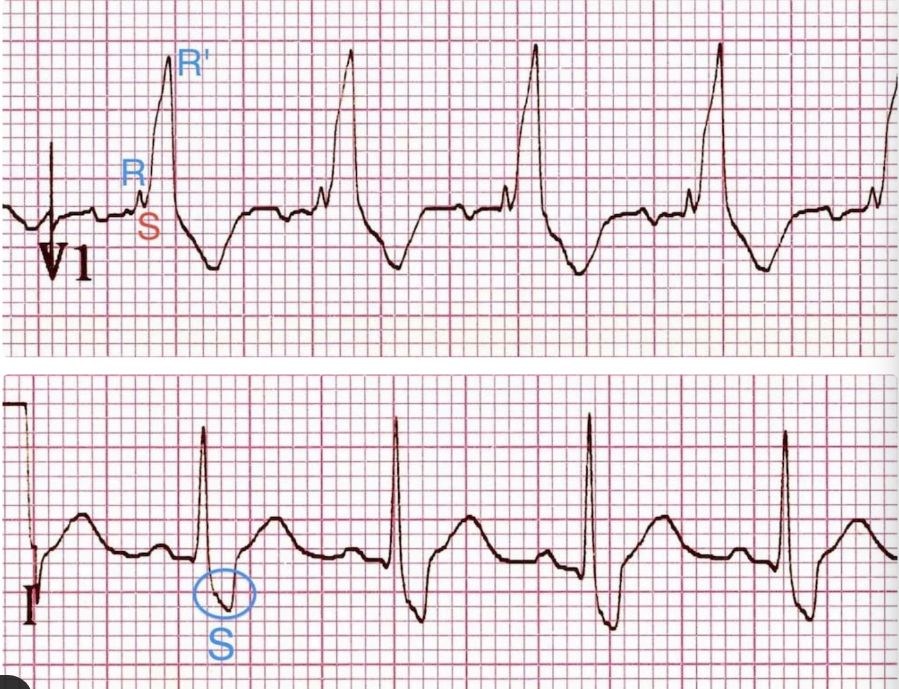 <p>What does this indicate</p>