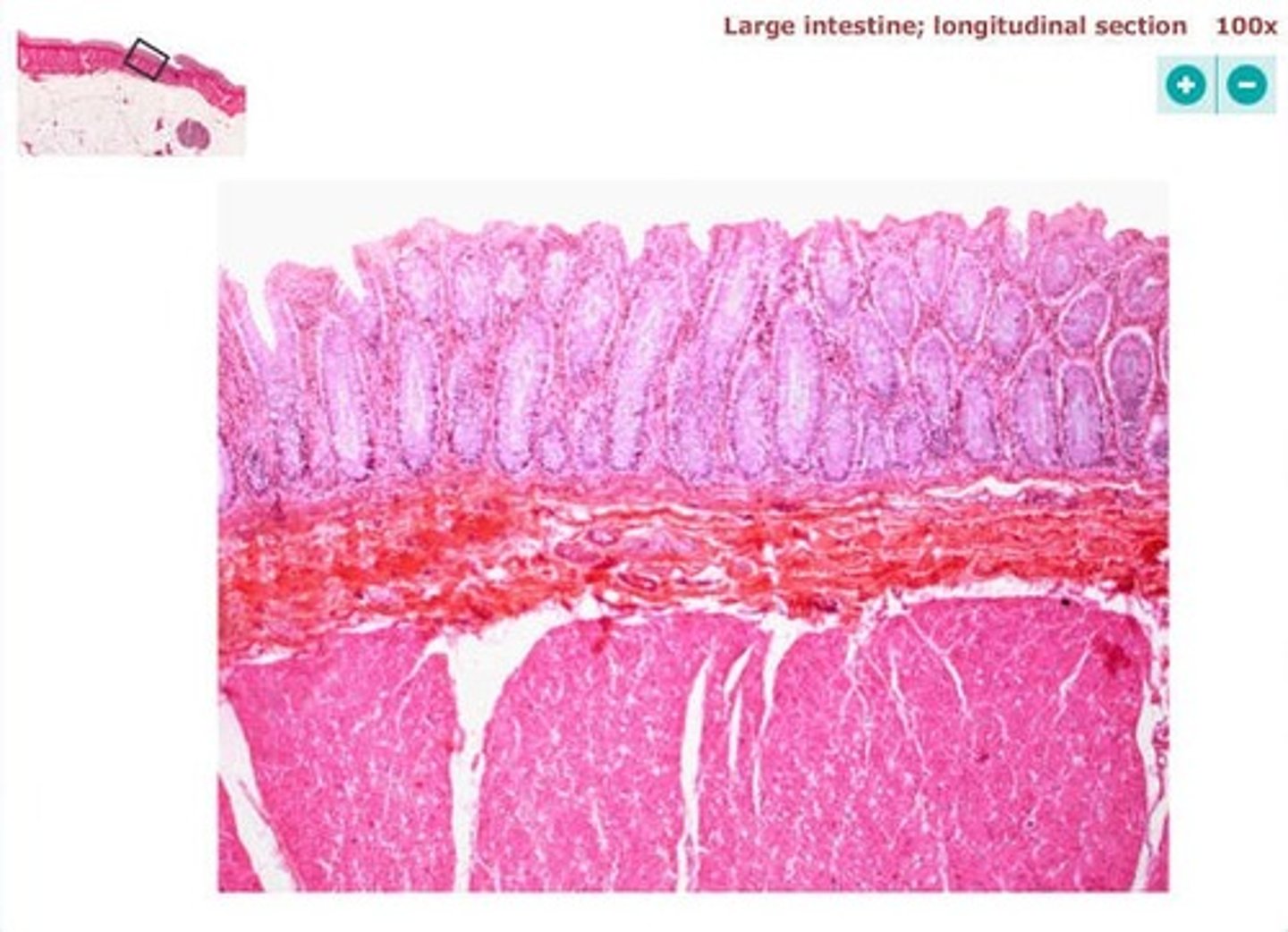 <p>simple columnar epithelium</p>
