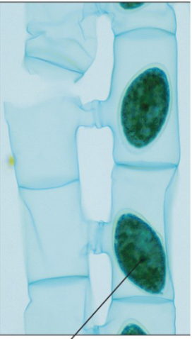 <p>What part of the Spirogyra is this line pointing to?</p>