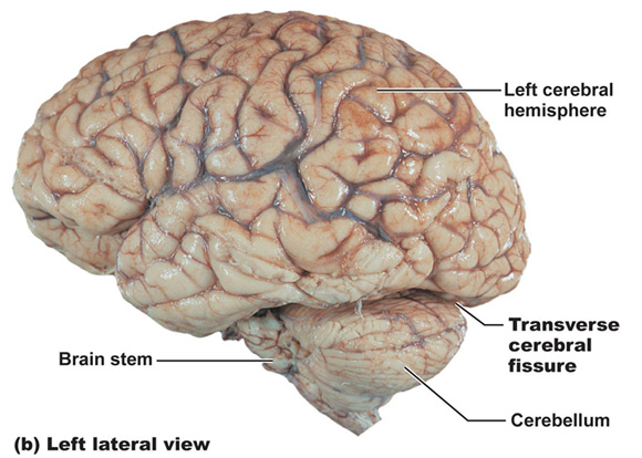 <p>separates occipital ad cerebellum (can be seen)</p>