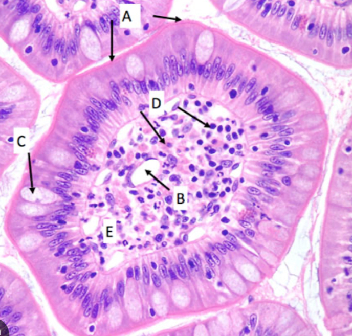 <p>In this sample of the GI tract, what does letter “C” point to?</p>