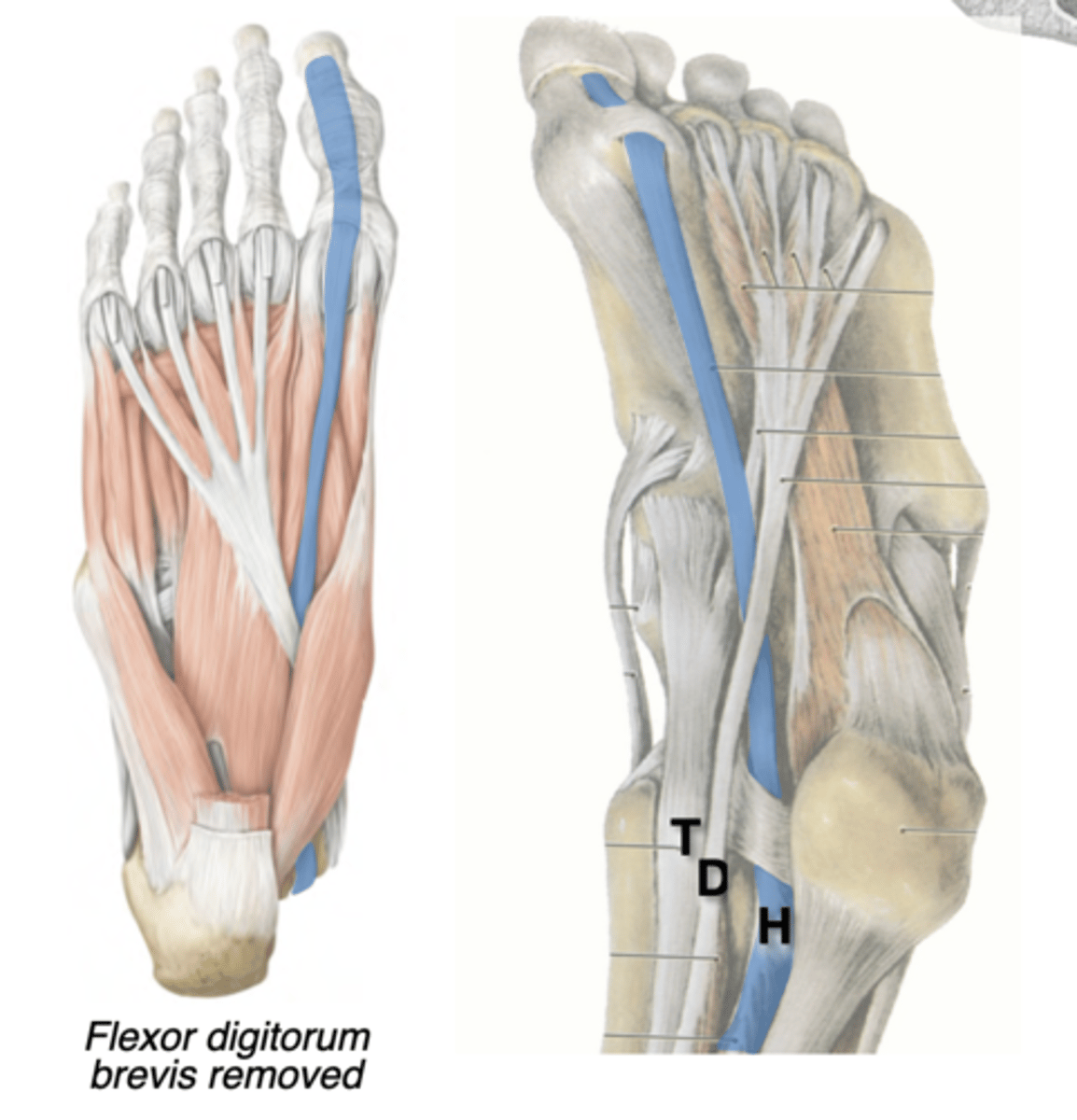 <p>Central compartment </p><p>Posterior leg --&gt; Tarsal tunnel (“Harry”) --&gt; Distal phalanx of digit 1</p><p>-Actions Flexes digit 1</p><p>Tendon passes through a tunnel between the flexor hallucis brevis sesamoids</p>