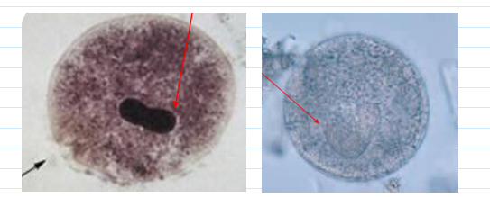 <ul><li><p><span>50-70, round with distinct cyst wall</span></p></li><li><p><span>Macronucleus; no cilia</span></p></li><li><p><span>Cytotsome—some have this</span></p></li><li><p><span>usually very circular; almost a perfect circle </span></p></li></ul><p></p>