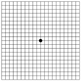 <p>The Amsler chart is used by the patient to monitor the progression of their visual loss. </p>