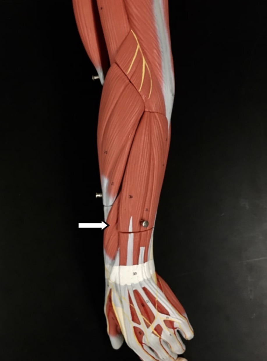 <p><span>Name the muscle labeled with the white arrow below.</span></p>