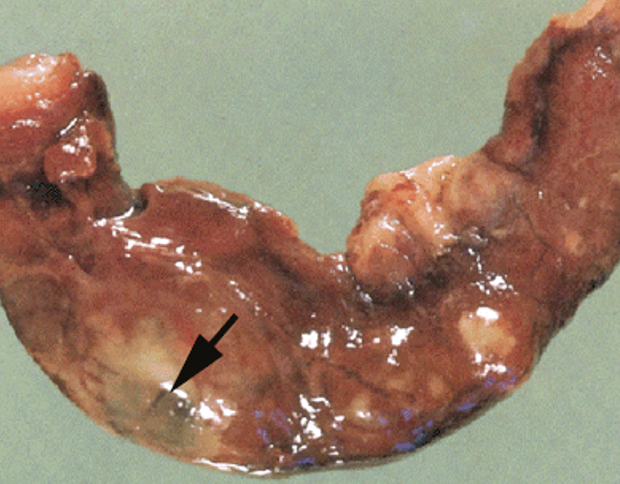 <p>وصفيه وهين يظهر؟</p><p>وهيش فيه</p>