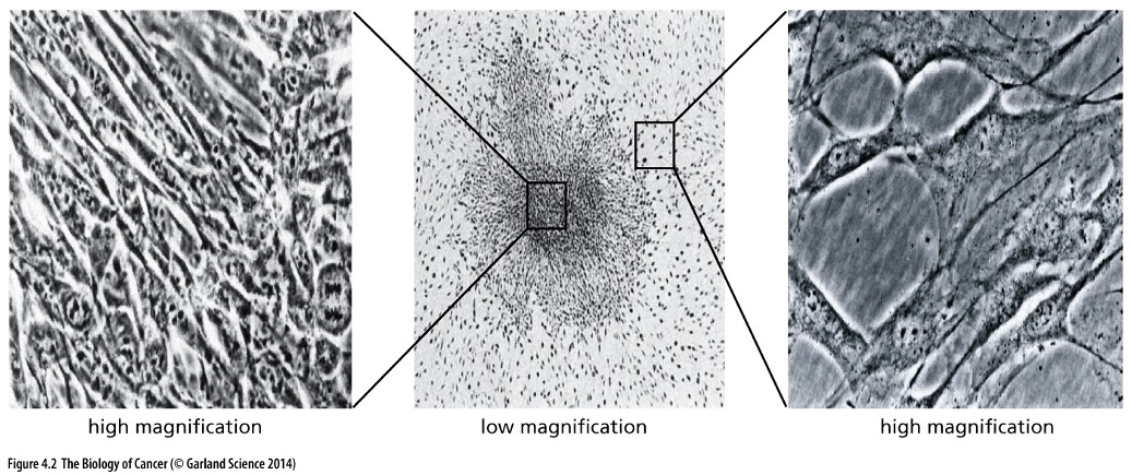 <p>Which picture shows normal cells?</p>