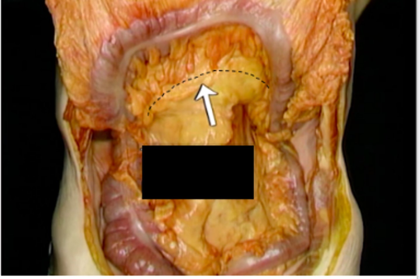 <p>What is this?</p>