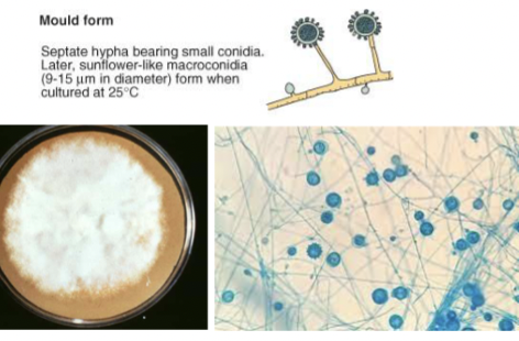 <p>Septate hyphae with small conidia and sunflower like macroconidia when cultured</p><p>Culture on SDA at 25</p>