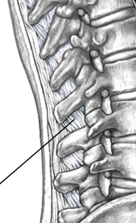 <p>Which ligament of the intervertebral is in between spinous process?</p>