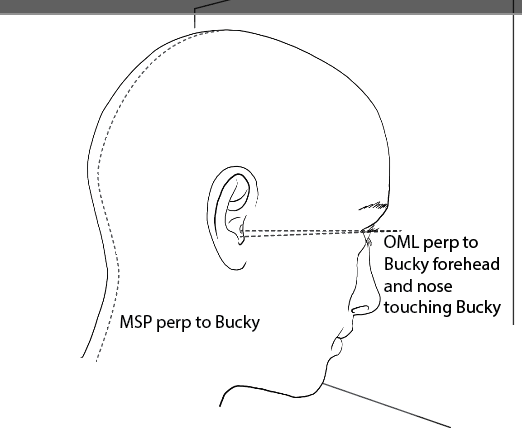 <p>facing bucky</p><p></p><p>OML perp to Bucky, nose and forehead touching</p>
