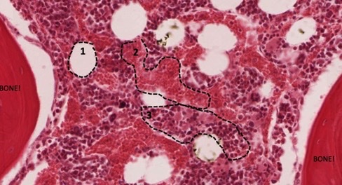 <p>what structures are seen in the bone marrow? 1, 2, unlabeled circle is 3</p>