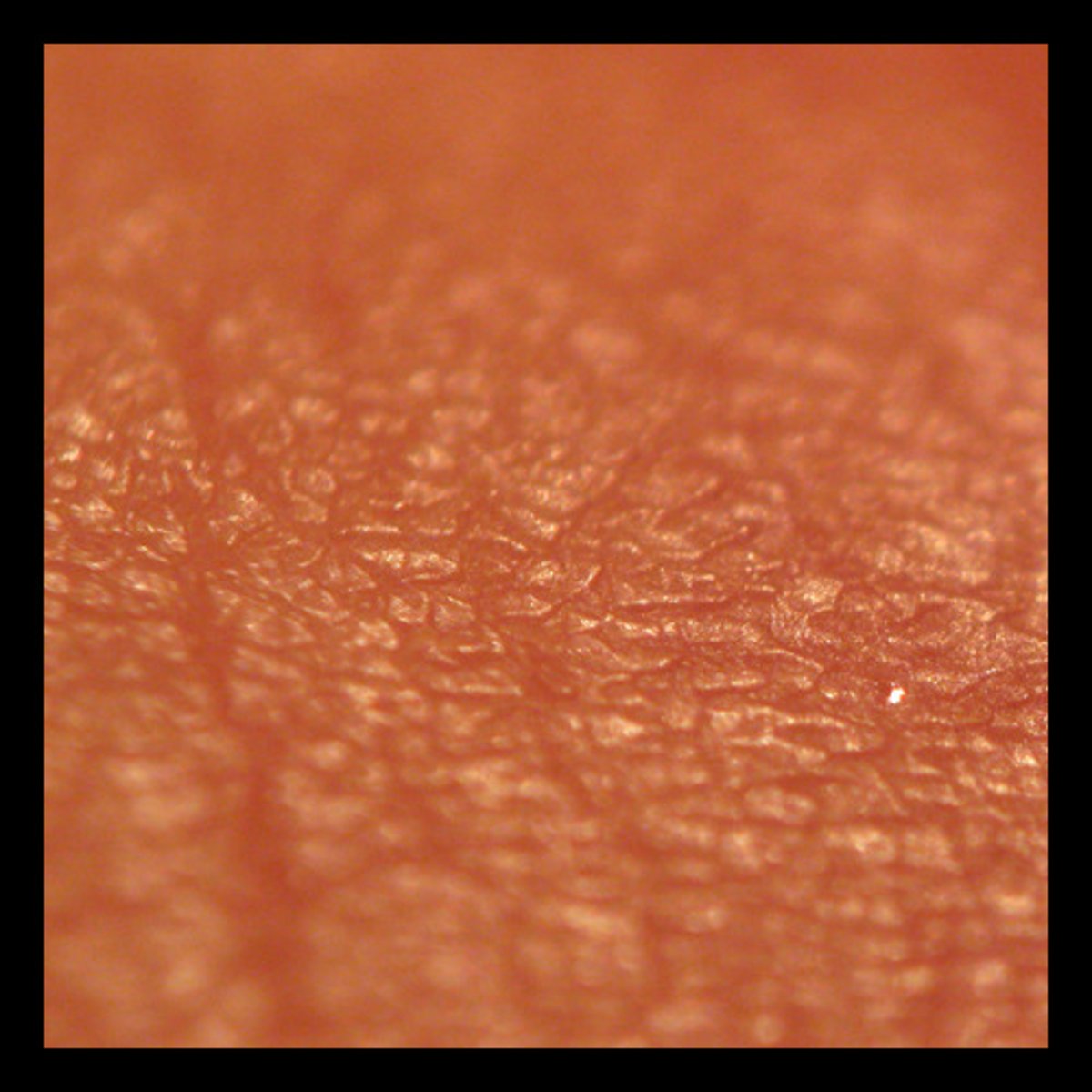 <p>skin</p>