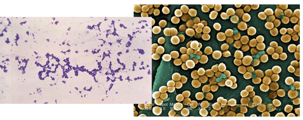 <p>Gram positive or gram negative bacteria?</p>
