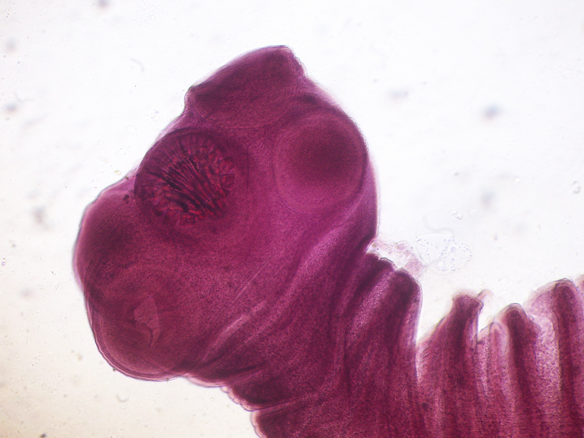 <p>This is an animal found in the flatworms &amp; flukes. These are also <strong>parasitic</strong>. They are composed of segments called proglottids.</p>