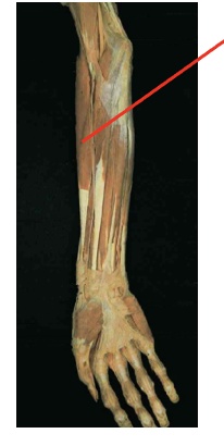 <p>What muscle is this What is its origin. Where does it inserts. </p>