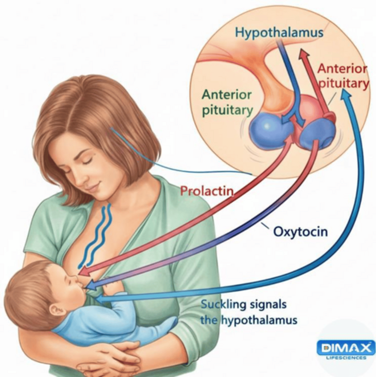 <p>Failure to lactate due to decreased prolactin.</p>