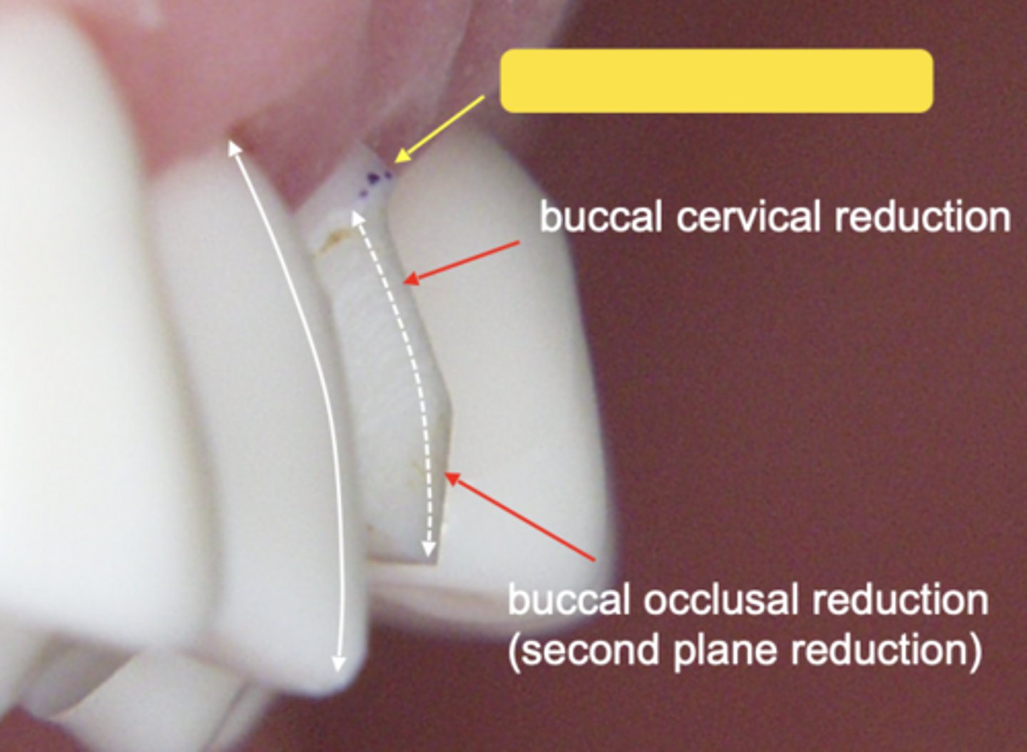 <p>What type of margin is this?</p>