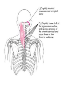 <p>Origin: Spinous process of C7 - T4</p><p>Insertion: Mastoid Process &amp; occipital bone</p><p>Action: Cervical Extension, Rotation, flexion</p>