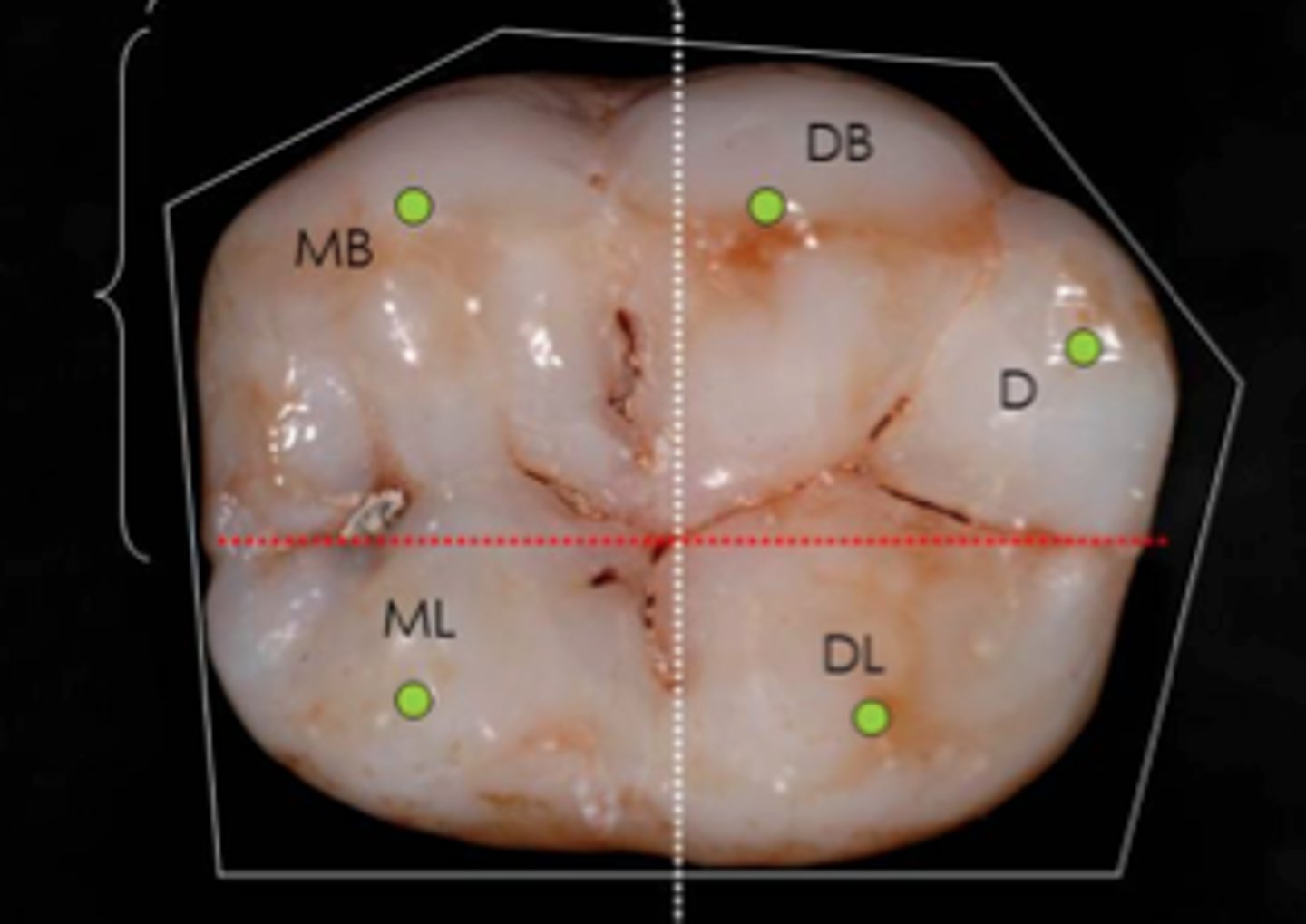 <p>1. mesiobuccal</p><p>2/3. mesiolingual and distolingual (same size)</p><p>4. distobuccal cusp</p><p>5. distal cusp</p><p>(Think MesioBuccal - MB - My Butt is the biggest)</p>
