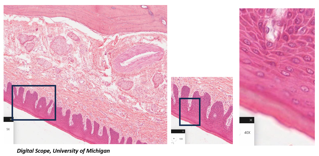 <p>Which mucosa is present in this image? How do you know?</p>