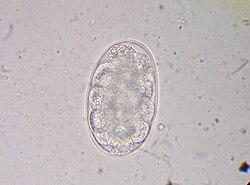 <p>zoonotic, in dogs, small animals, human feces</p><p>dermatitis, anemia, respiratory damage</p><p>tropic/subtropics, warm regions</p>