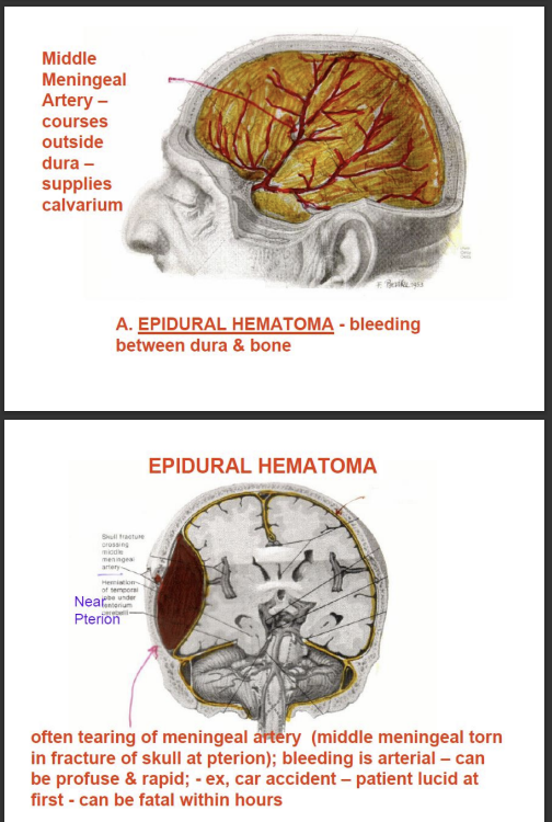 <p>courses outside the dura</p><p>supplies the calvarium </p><p>epidural hematoma - bleeding between the dura and bone</p>