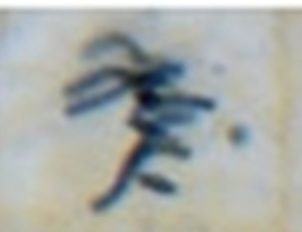 <p>What is the image?</p>