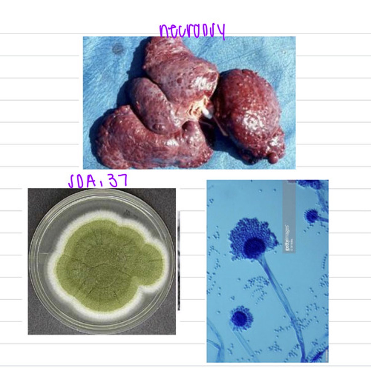<p>a vet does a necropsy on a dog and removes the liver. if we know the dog had eaten some fungus infected crops, what can we guess is the diagnosis?</p>