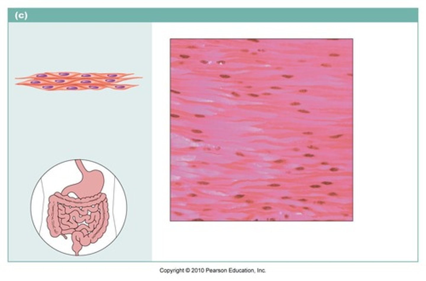 <p>name the type of muscle tissue</p>