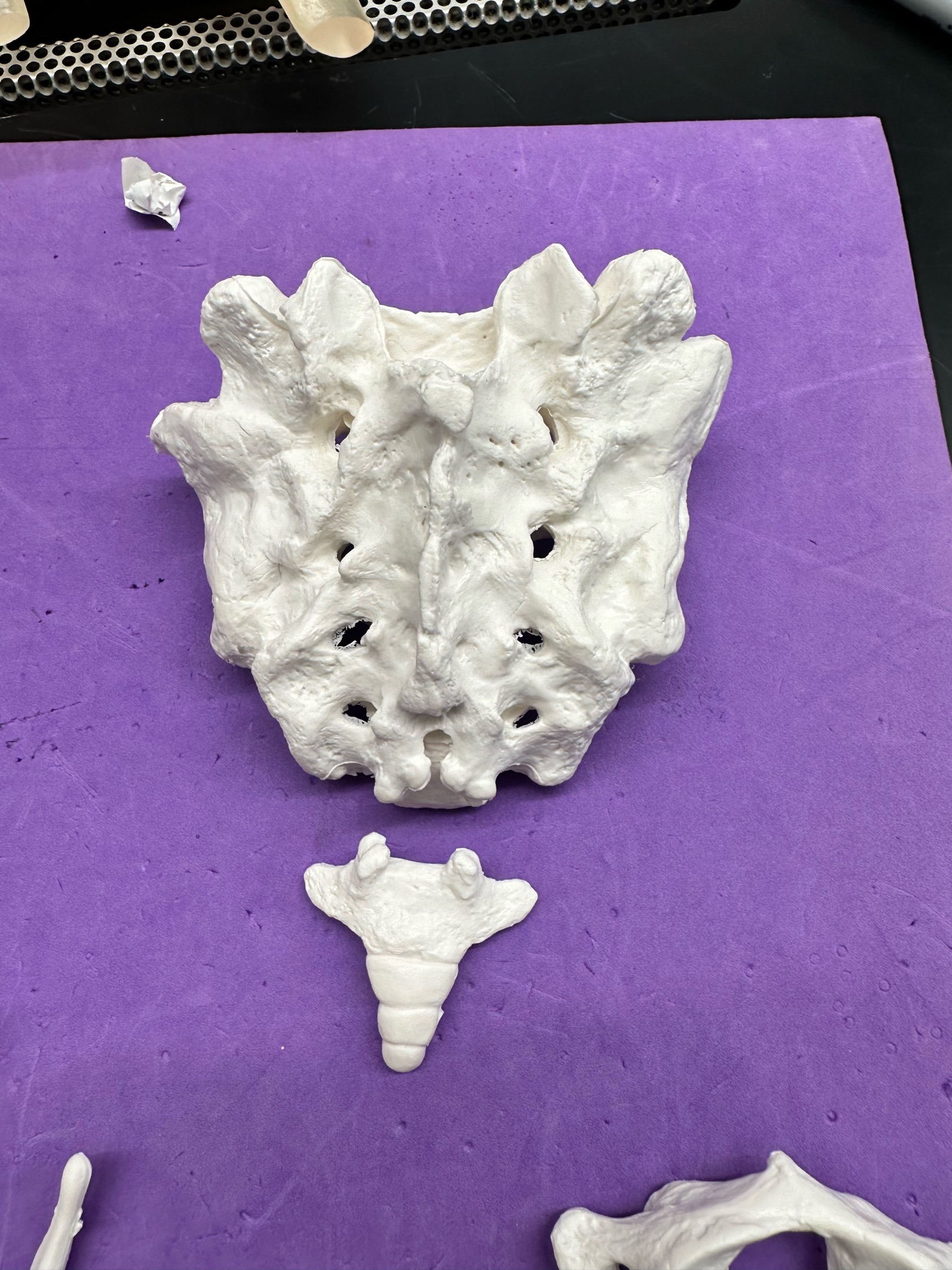 <p>ID bone</p>