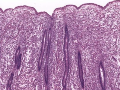 what phase of endometrial cycle