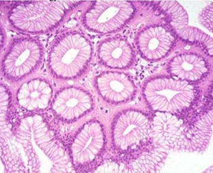 <p>Colon/Large Intestine</p>