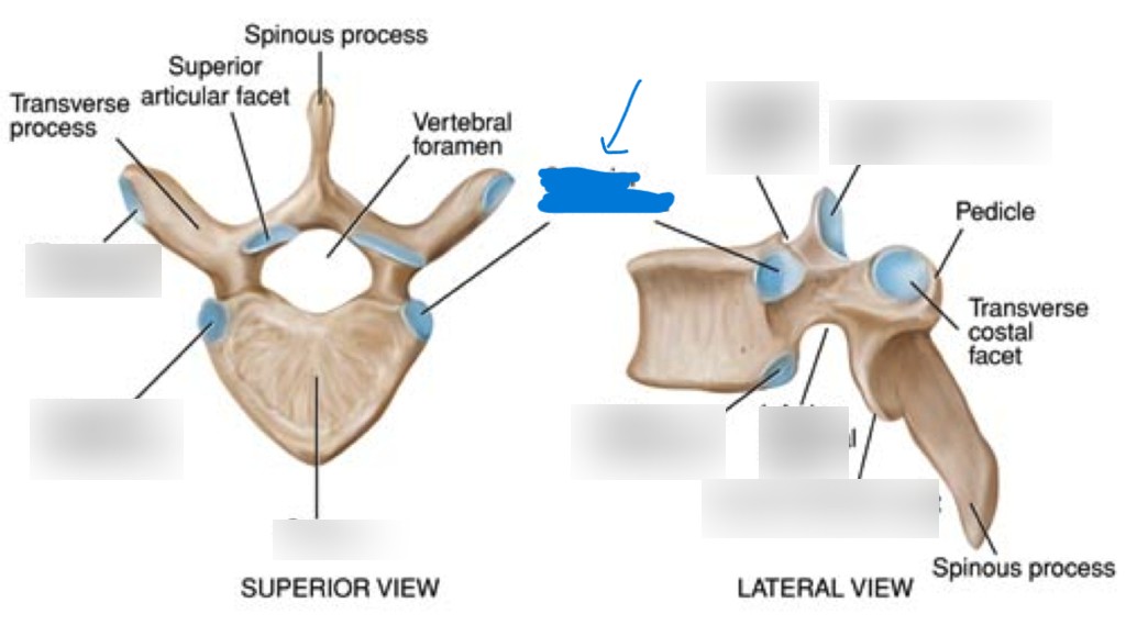 <p>What is this part of the vertebrae?</p>