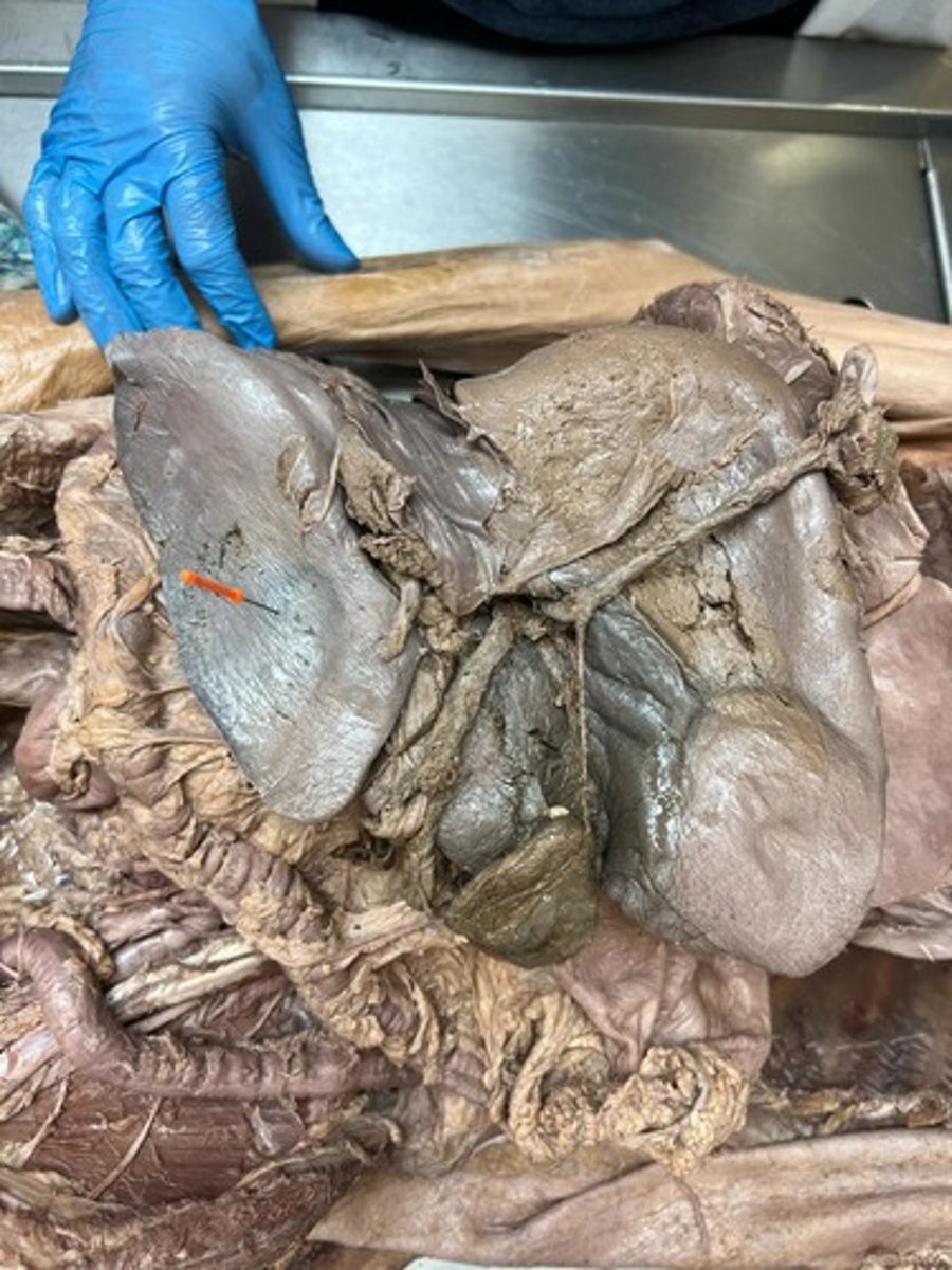 <p>left lobe of liver</p>