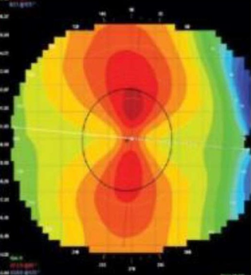<p>Name the finding.</p>