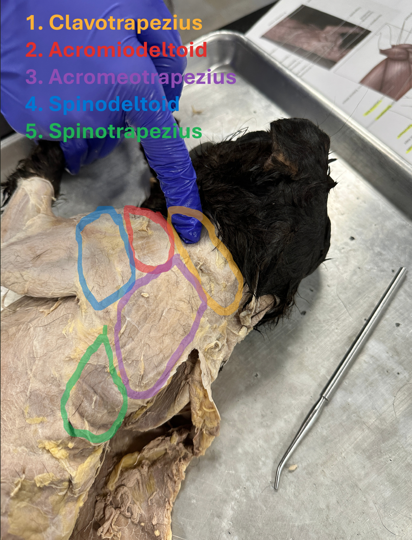 <p>Spinodeltoid (Posterior shoulder and back muscles)</p>