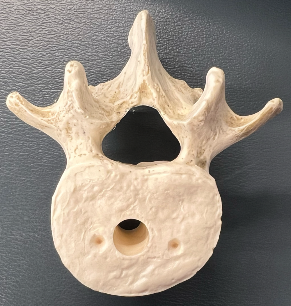 Which group does this vertebrae belong to? 