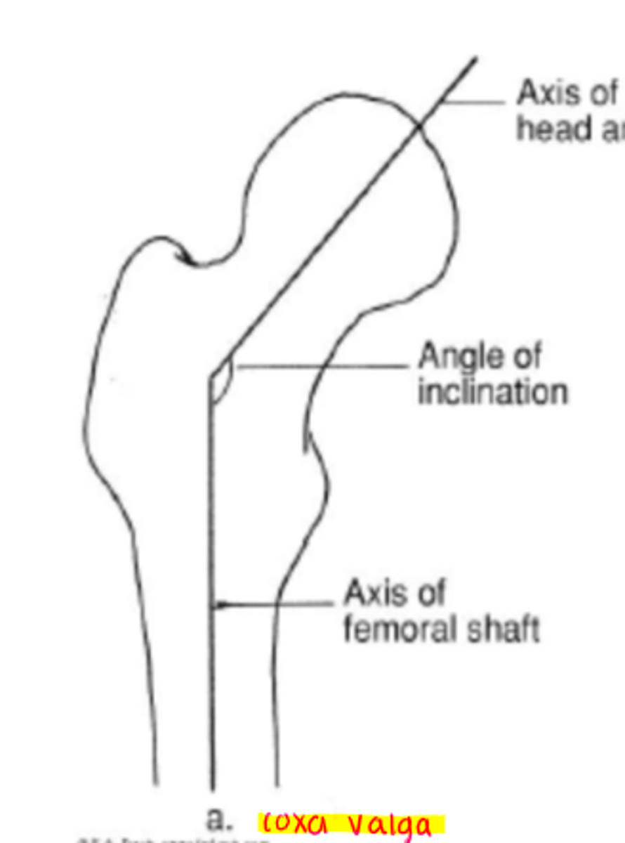 <p>increased angle of inclination</p><p>*greater than 144 degrees</p>