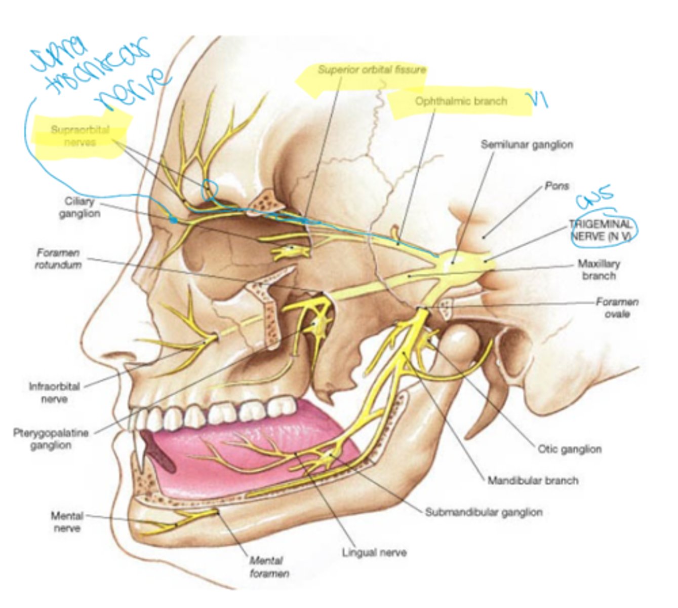 <p>CNV1 (supratrochlear nerve), artery, and vein pass through the foramen/notch</p>
